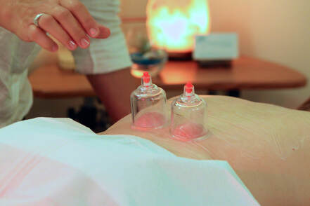 Patient receiving cupping treatment.